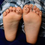 voetpijn voeten kind huid